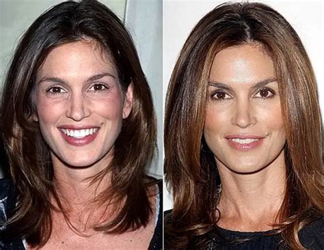 cindy crawford nose|Cindy Crawford’s Iconic Look: How Her Facial Features